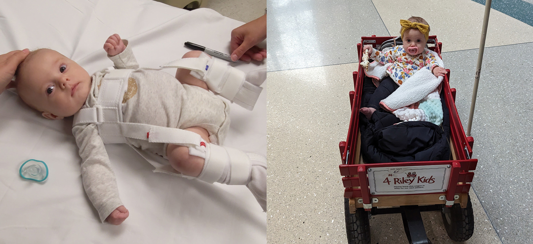 Two photos of Kara's daughter, Charlotte, at the hospital receiving treatment